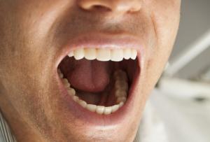 Unen tulkinta hampaista, miksi haaveilet hampaista unessa?